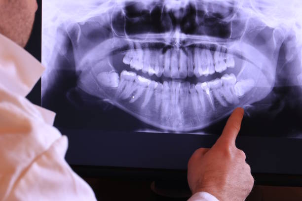 Best Same-Day Emergency Dental Services in Old Fig Garden, CA