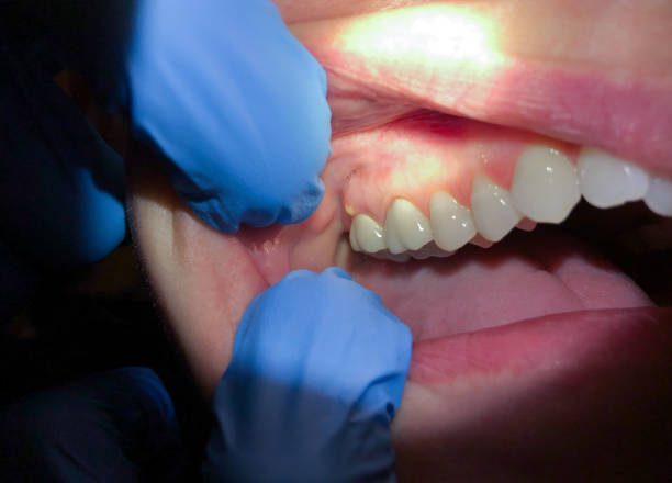 Best Emergency Orthodontic Services in Old Fig Garden, CA