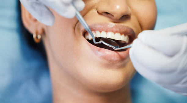 Best Cosmetic Emergency Dentistry in Old Fig Garden, CA