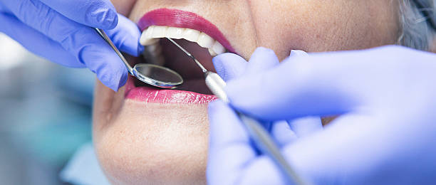 Best Pediatric Emergency Dentist in Old Fig Garden, CA